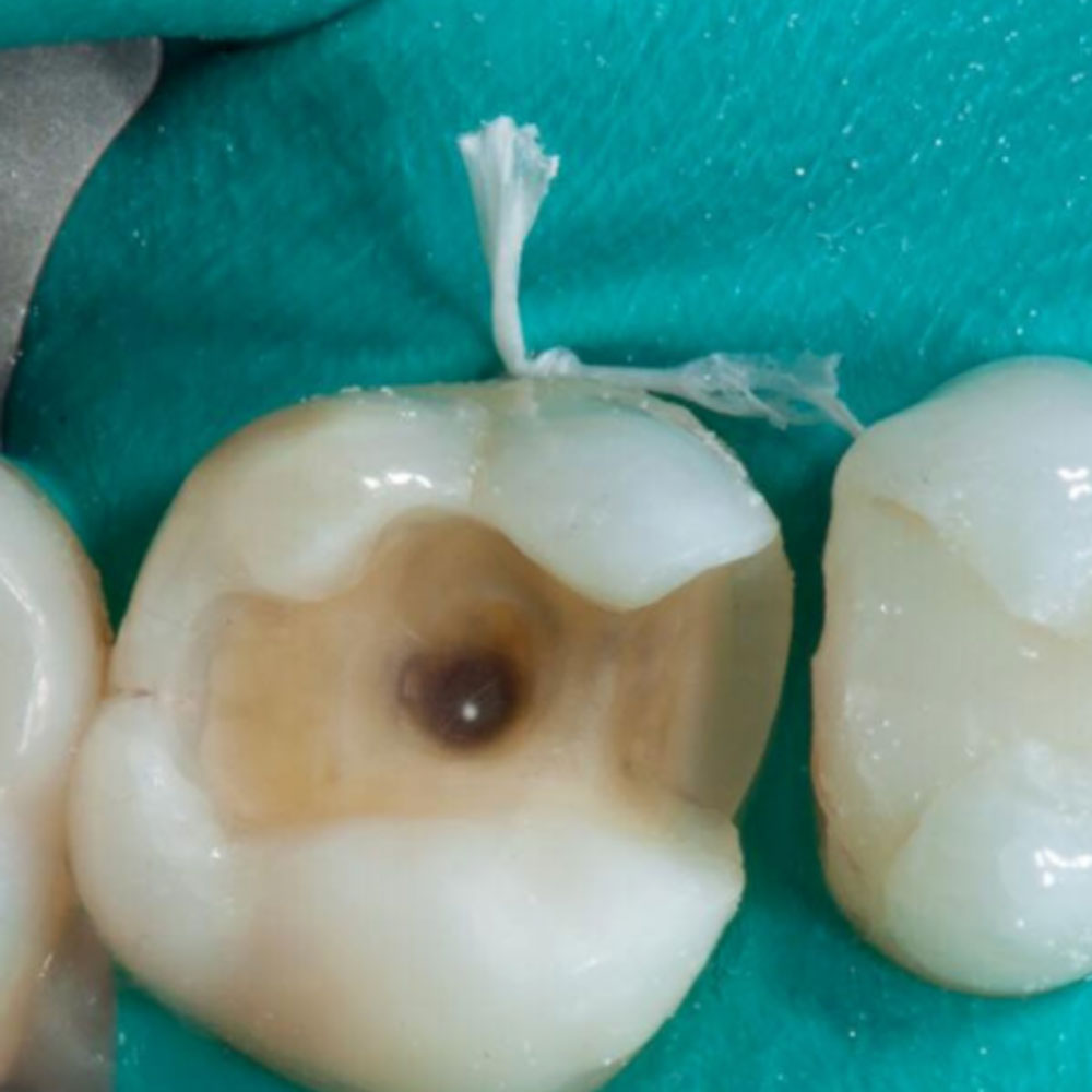 Can dental therapists do teeth whitening