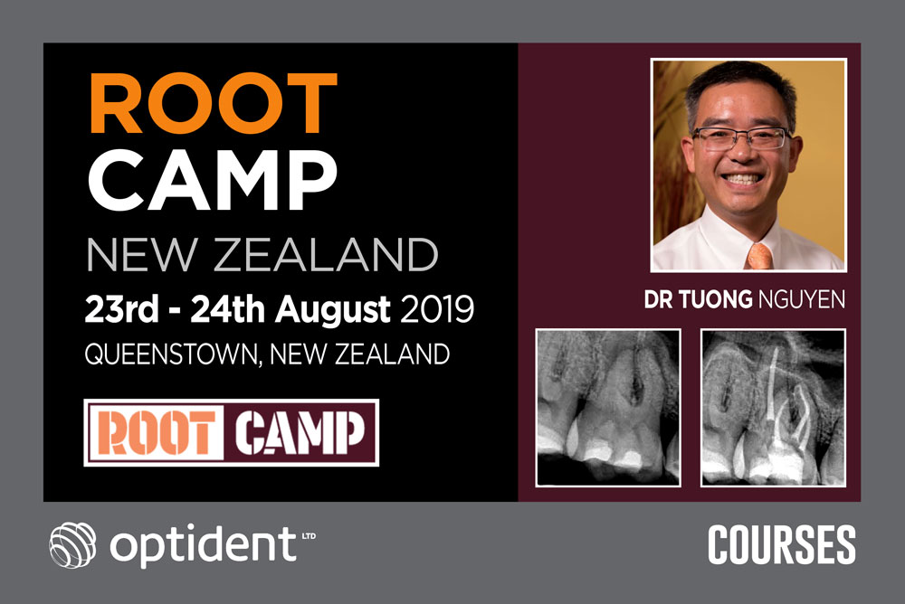 Root Camp – New Zealand
