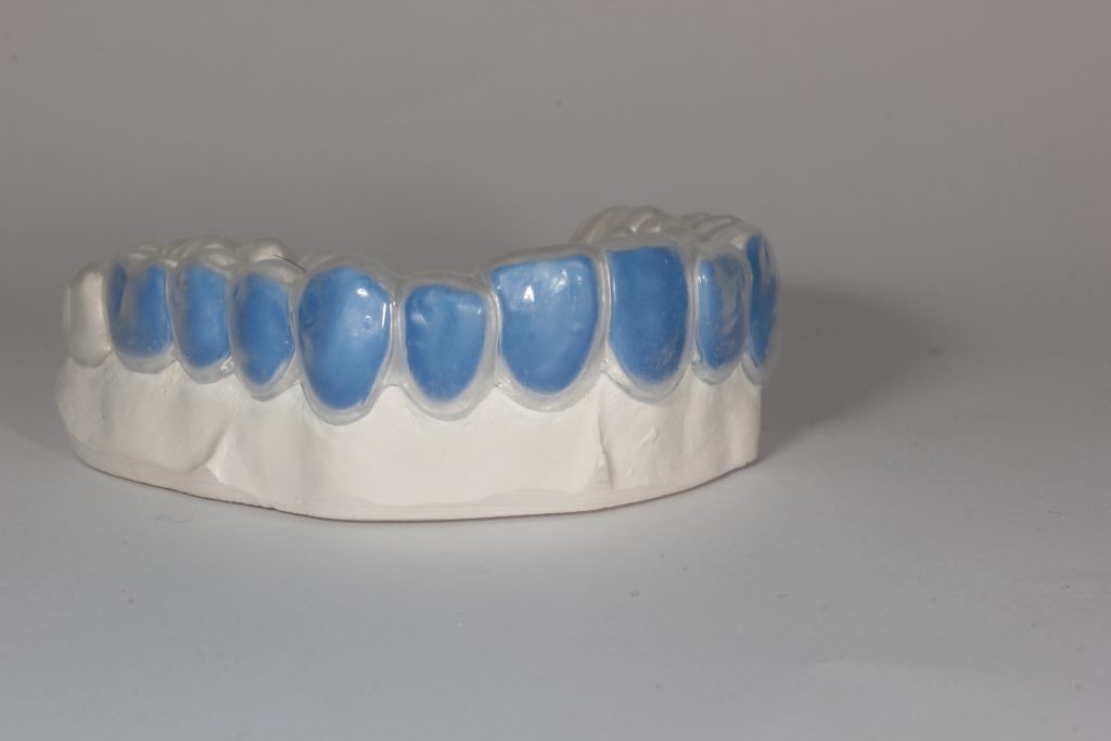 Labline Custom Bleaching Trays