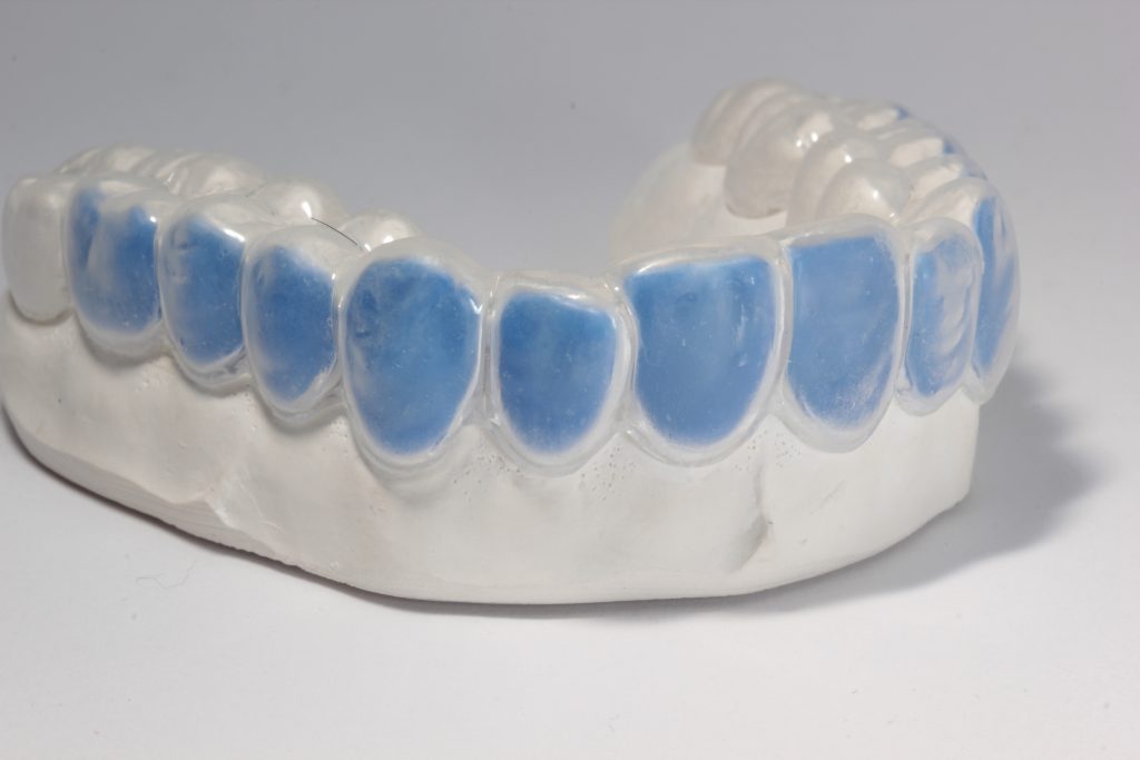 Labline Custom Whitening Trays