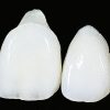 ENAMEL PLUS HFO Dentine Syringe UD1 - Optident Ltd