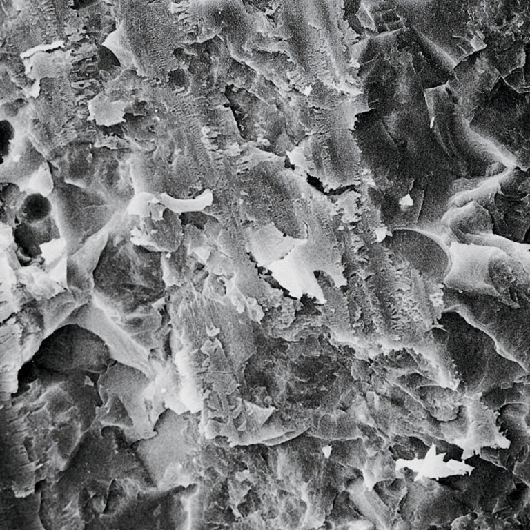 Porcelain Etch Kit Optident Specialist Dental Products And Courses