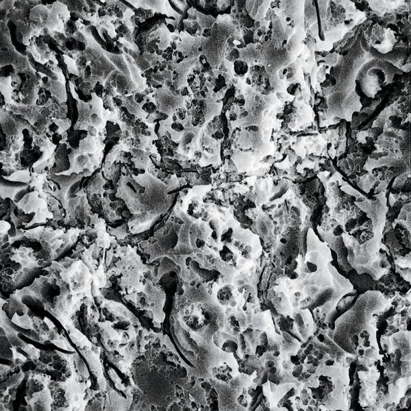 Porcelain Etch Kit Optident Specialist Dental Products And Courses