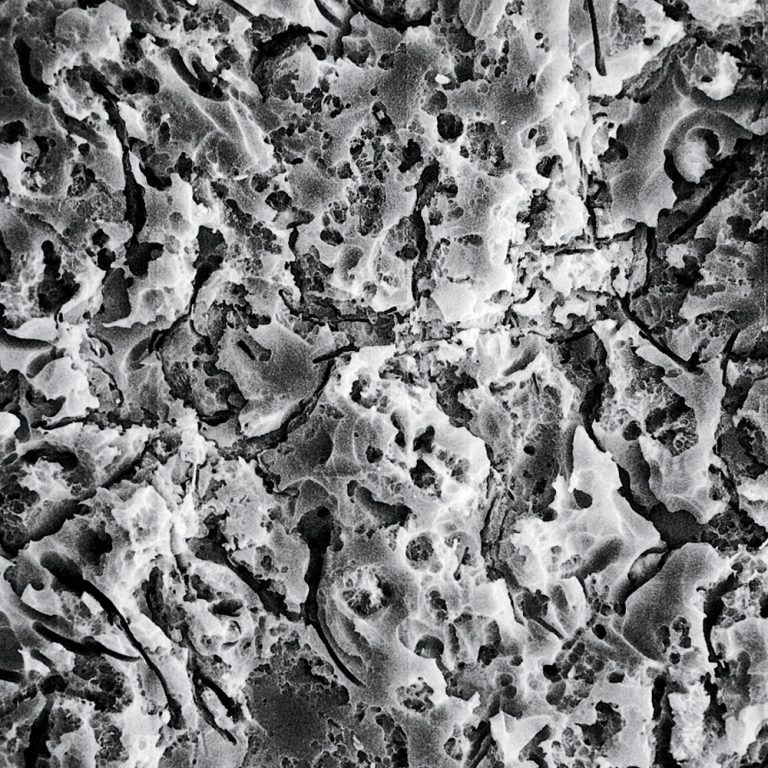 Porcelain Etch Kit Optident Specialist Dental Products And Courses