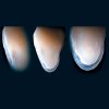 ENAMEL PLUS HFO Dentine Tips UD3.5 - Optident Ltd