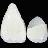 ENAMEL PLUS HFO Dentine Tips UD6 - Optident Ltd