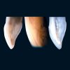 Enamel Plus HFO 5g Syringe OW - Image 9