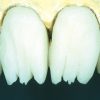 Enamel Plus Temp Dentine B3 - Image 5