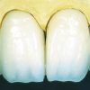 Enamel Plus Temp Dentine B3 - Image 8