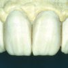 Enamel Plus HFO Temp Resin Intro Kit - Image 2