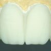 Enamel Plus HFO Temp Resin Intro Kit - Image 4