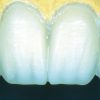 Enamel Plus HFO Temp Resin Intro Kit - Image 7