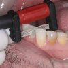 FitStrip Handles - Image 2
